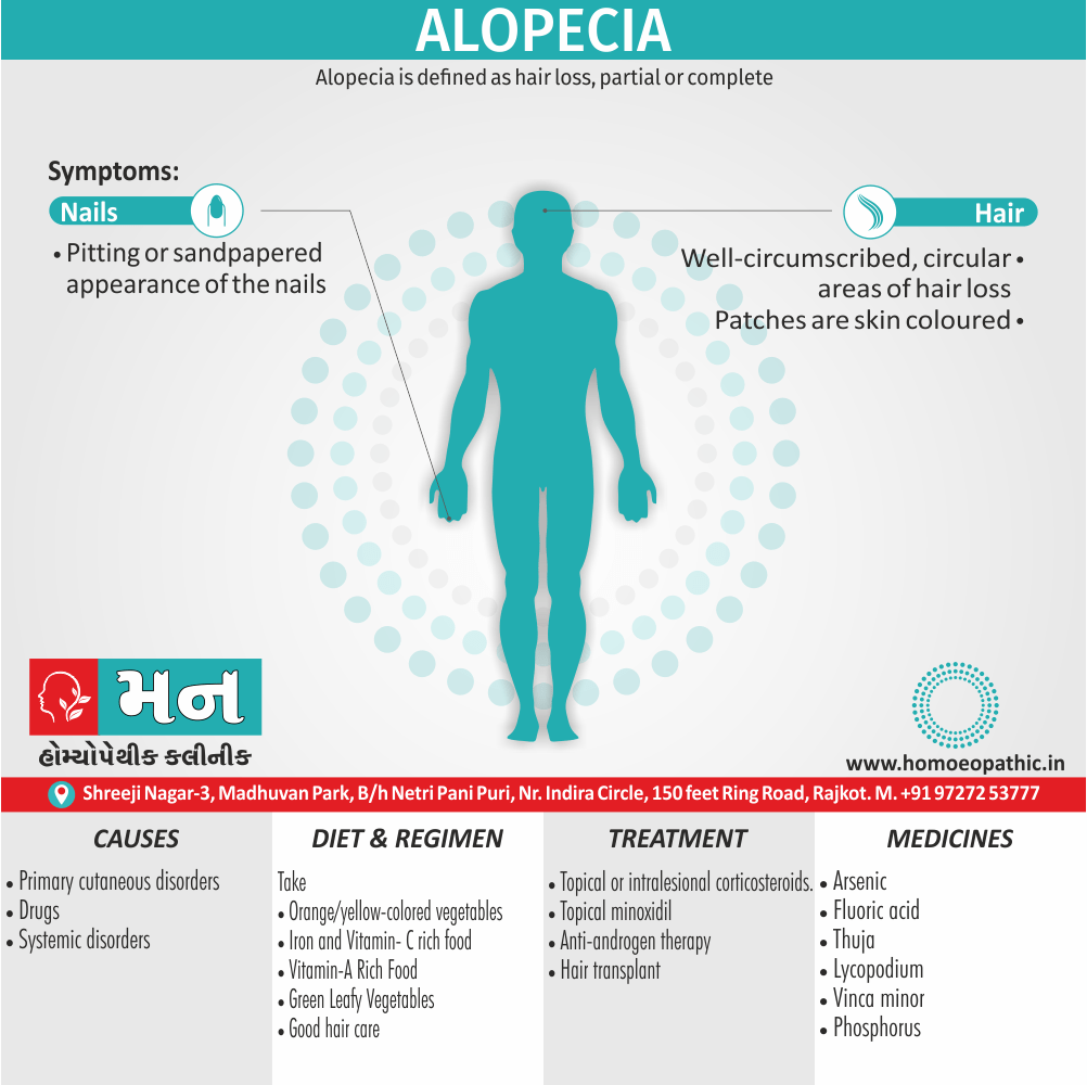 Alopecia Definition Symptoms Cause Diet Homeopathic Medicine Treatment Homeopathy Doctor Clinic in Rajkot Gujarat India