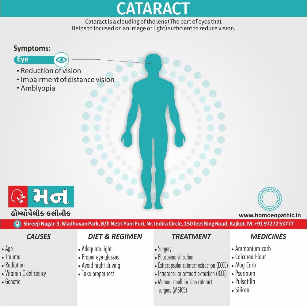 Cataract Definition Symptoms Cause Diet Regimen Homeopathic Medicine Homeopath Treatment in Rajkot India