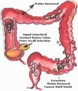 Causes Constipation