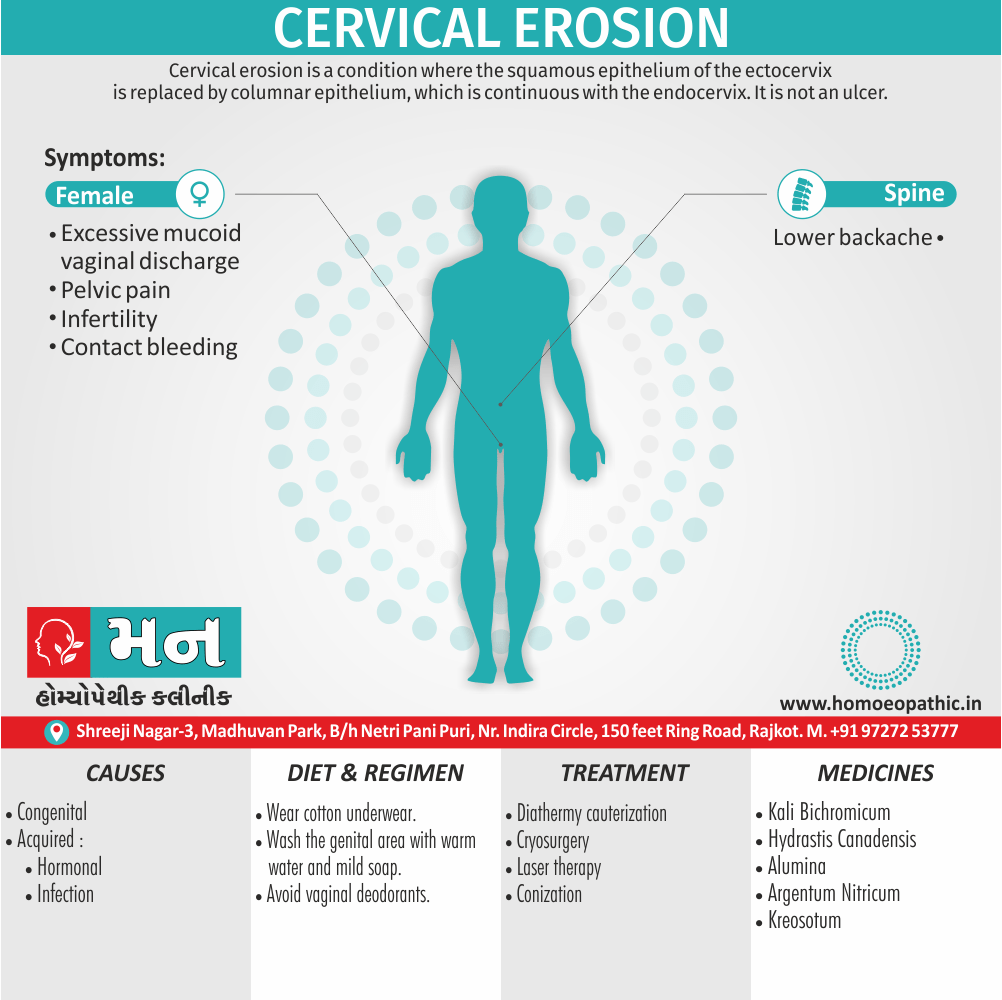 Cervical Erosion Definition Symptoms Cause Diet Homeopathic Medicine Treatment Homeopathy Doctor Clinic in Rajkot Gujarat India