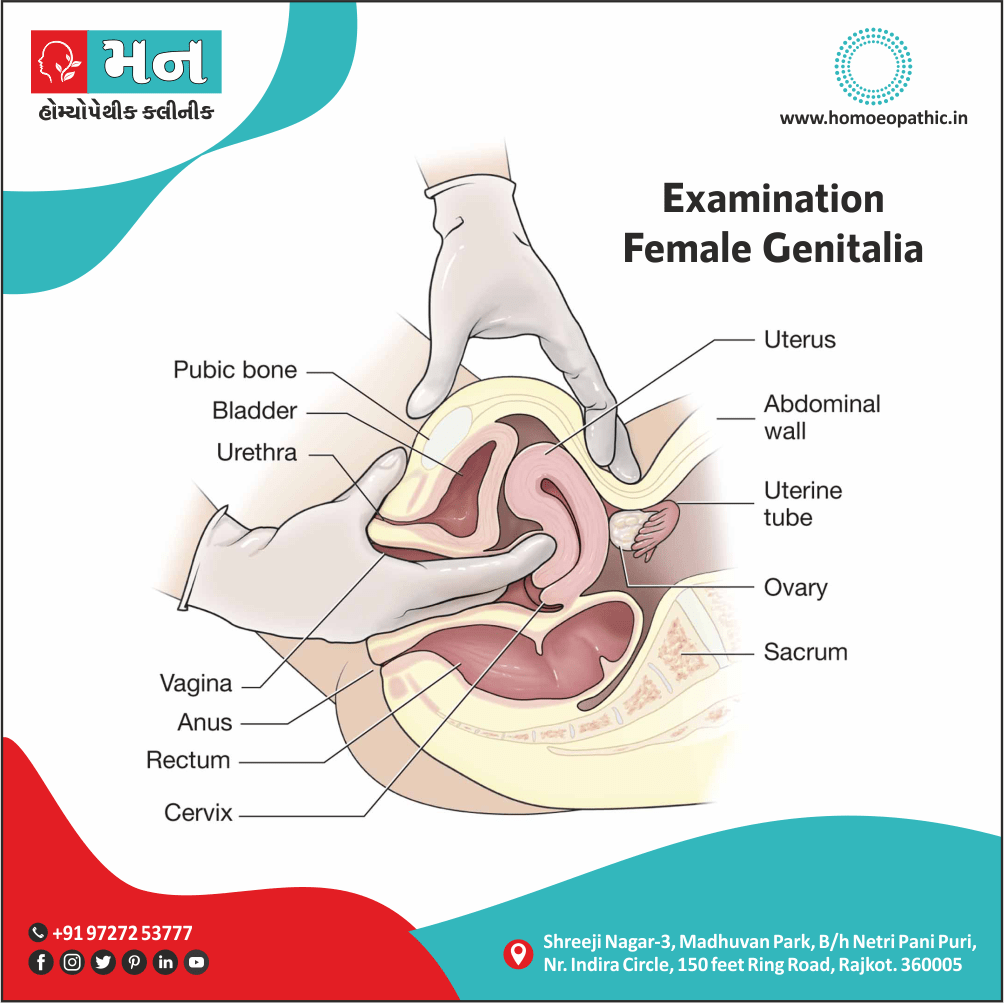Examination Of Female Genitalia Definition Symptoms Cause Diet Regimen Homeopathic Medicine Homeopath Treatment in Rajkot India