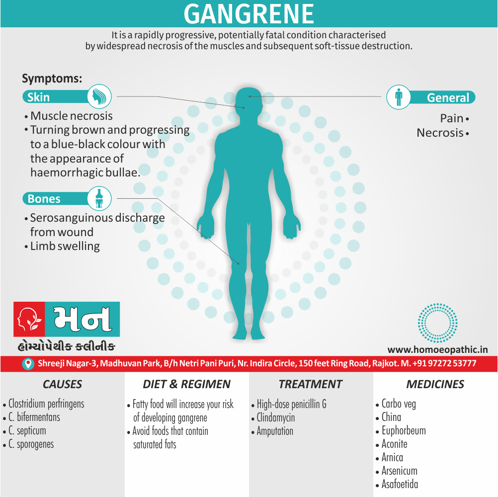 Gangrene Definition Symptoms Cause Diet Regimen Homeopathic Medicine Homeopath Treatment in Rajkot India