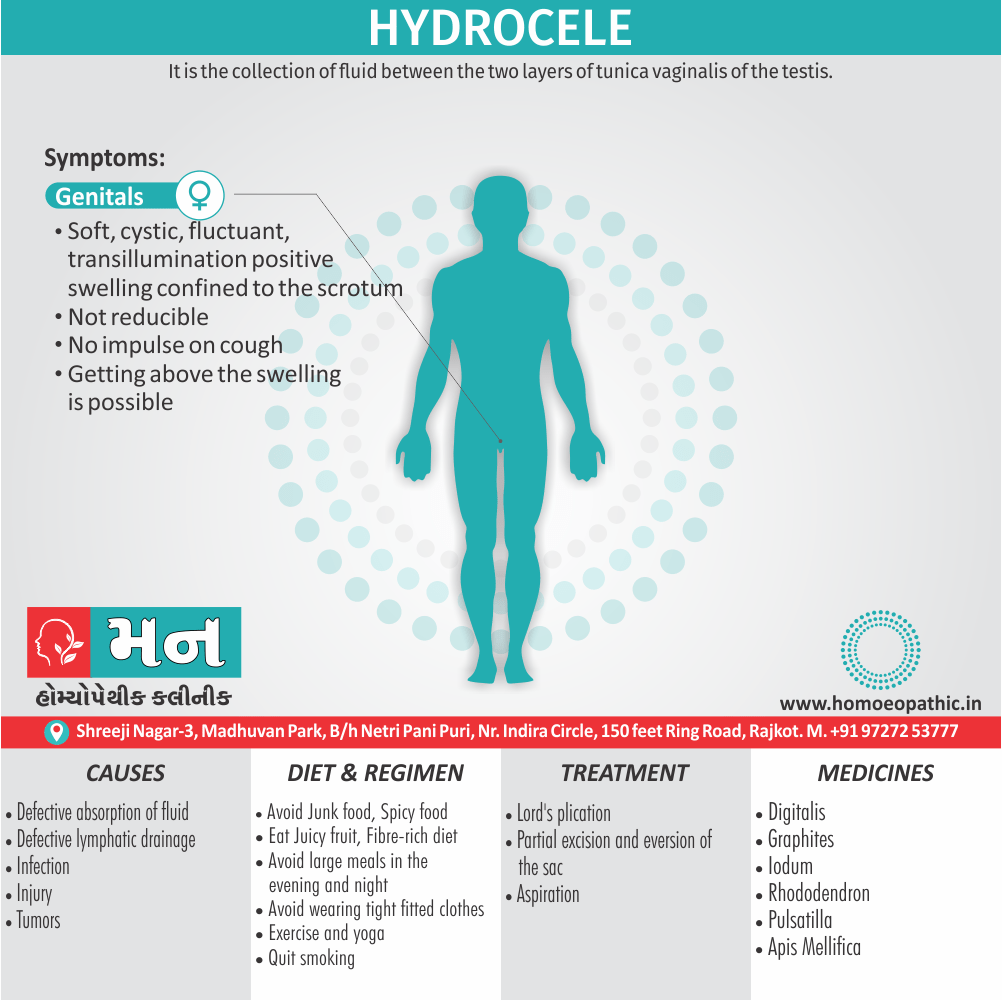 Hydrocele