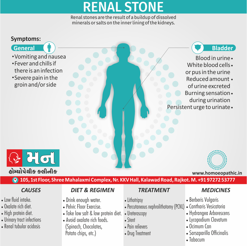 Renal Stone Definition Symptoms Cause Diet Regimen Homeopathic Medicine Homeopath Treatment In Rajkot India