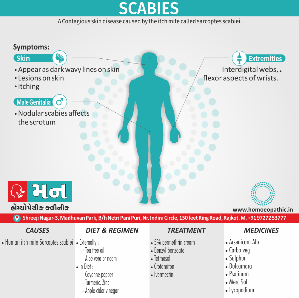 Scabies Definition Symptoms Cause Diet Homeopathic Medicine Treatment Homeopathy Doctor Clinic in Rajkot Gujarat India