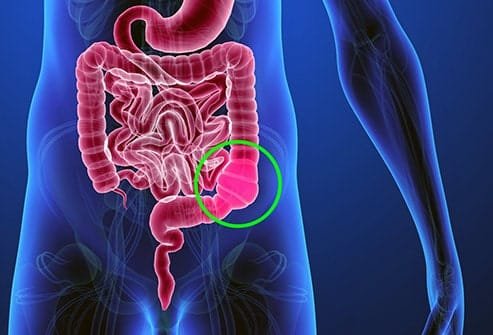 Sign and Symptoms of Constipation