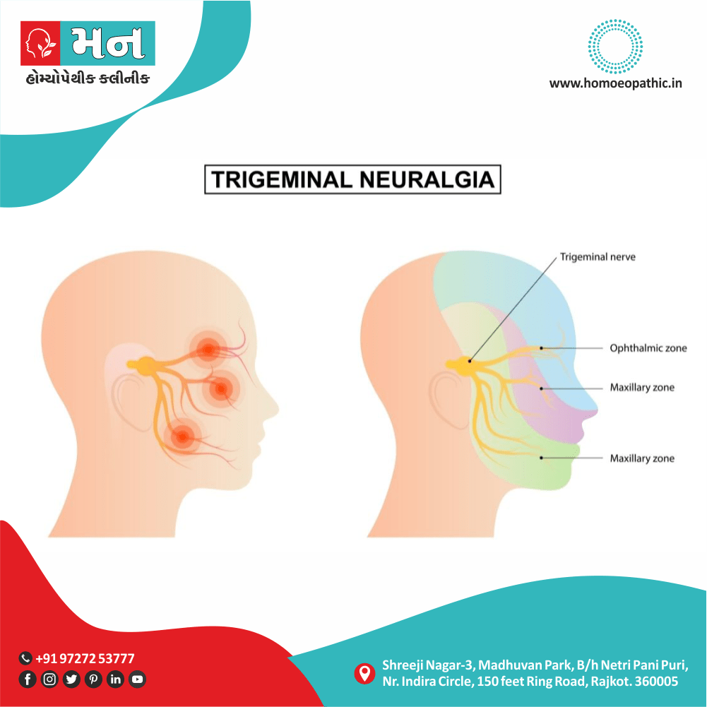ટ્રાયજેમીનલ ન્યુરાલ્જીયા Trigeminal Neuralgia Definition Symptoms Cause Diet Homeopathic Medicine Treatment Homeopathy Doctor Clinic in Rajkot Gujarat India
