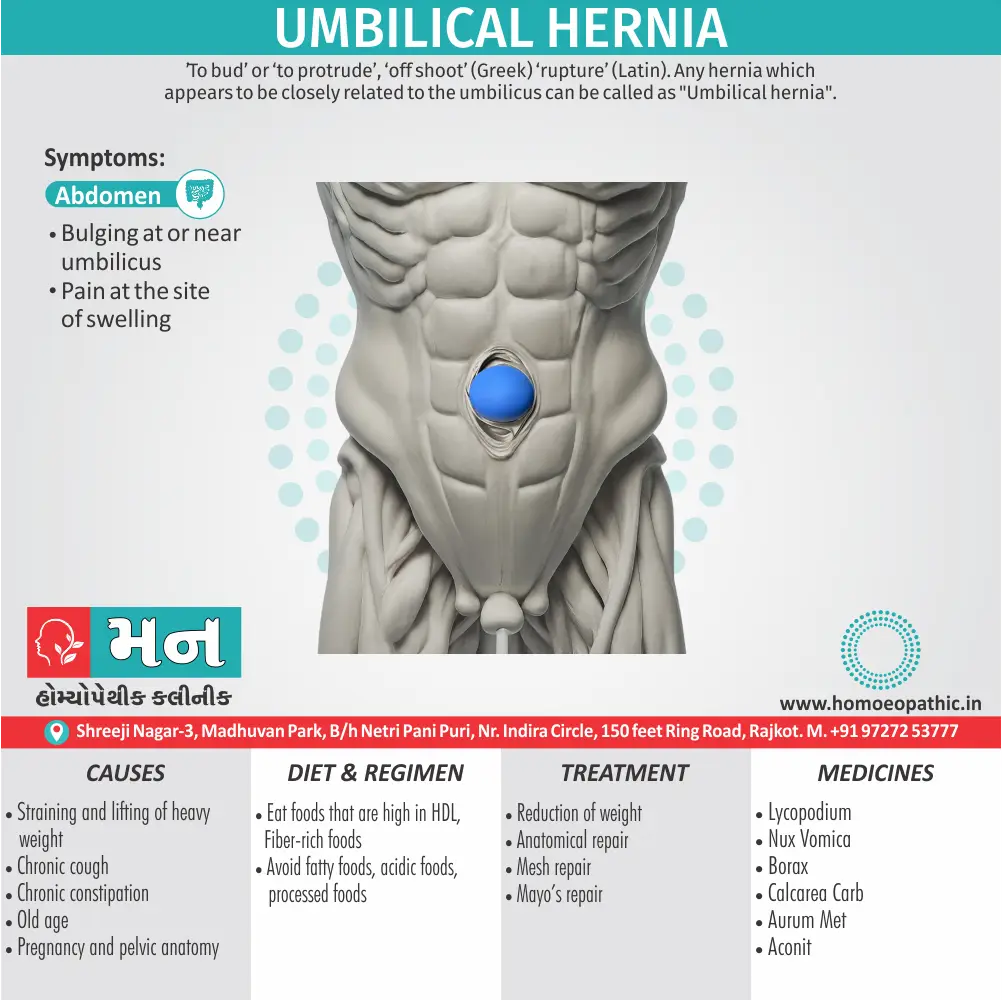 Umbilical Hernia Symptoms Cause Homeopathic Medicine Homeopath Treatment in Rajkot Gujarat India