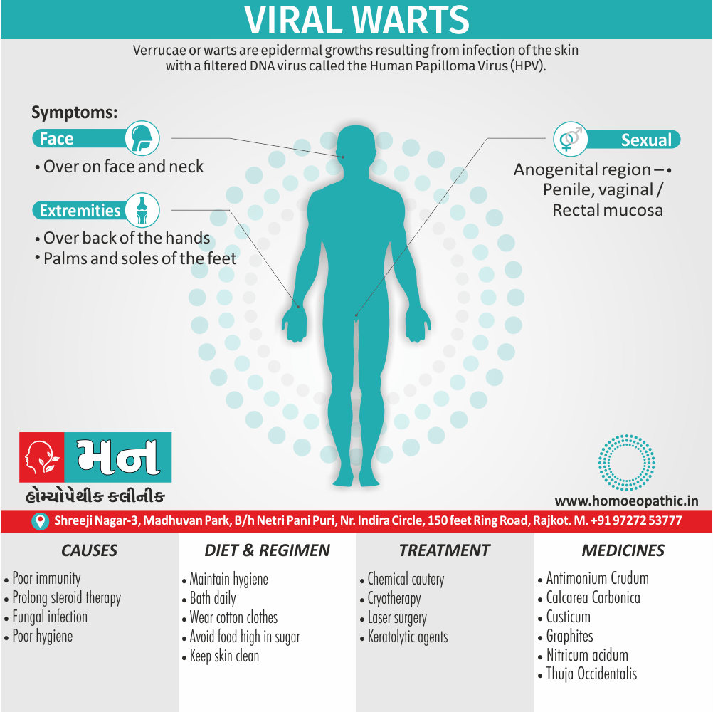 Viral Warts Definition Symptoms Cause Diet Homeopathic Medicine Treatment Homeopathy Doctor Clinic in Rajkot Gujarat India