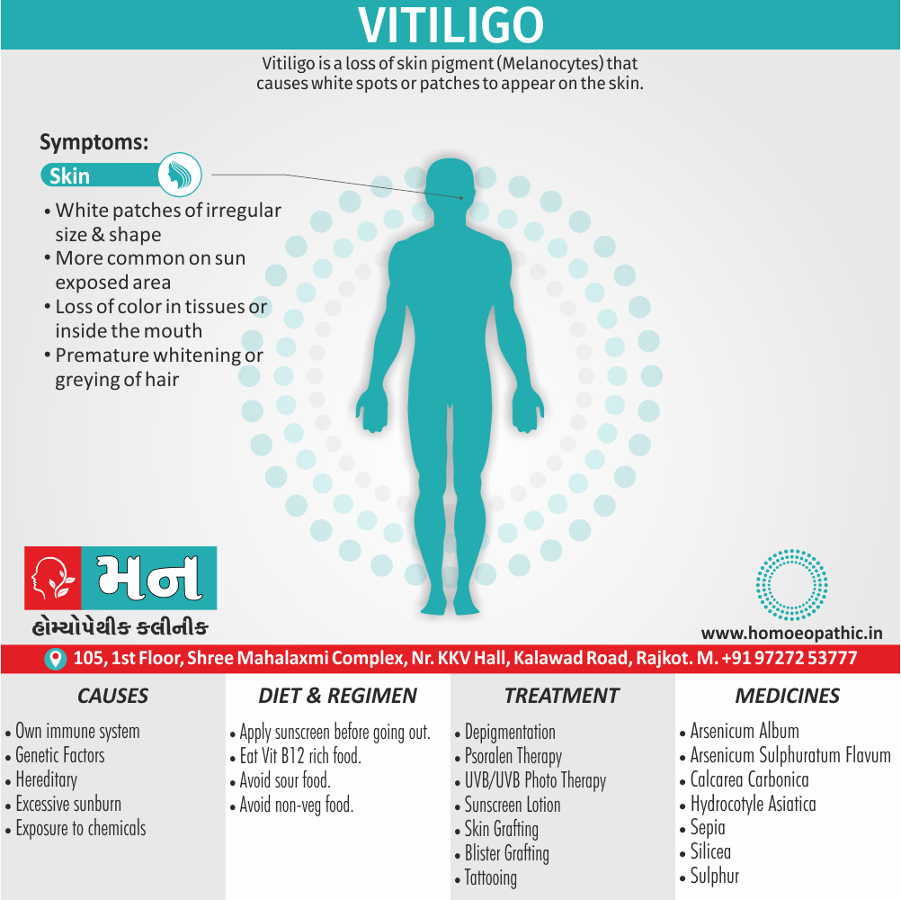 Vitiligo Definition Symptoms Cause Diet Regimen Homeopathic Medicine Homeopath Treatment In Rajkot India